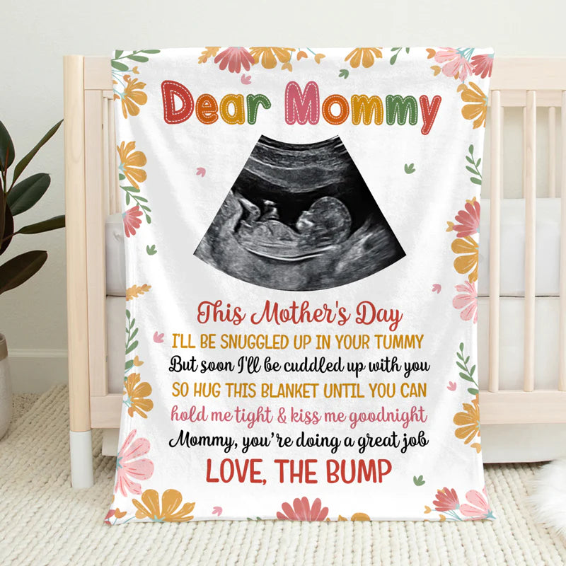 First Mom Blanket - Baby B-ultrasound Photo Blanket,Personalized Custom Baby Blanket