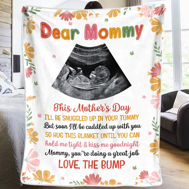 First Mom Blanket - Baby B-ultrasound Photo Blanket,Personalized Custom Baby Blanket