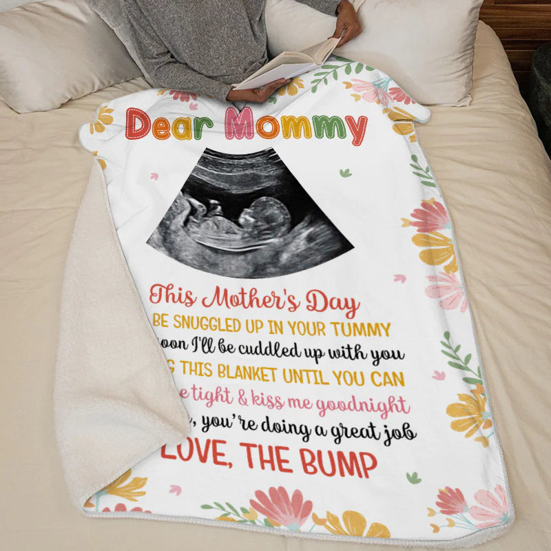 First Mom Blanket - Baby B-ultrasound Photo Blanket,Personalized Custom Baby Blanket