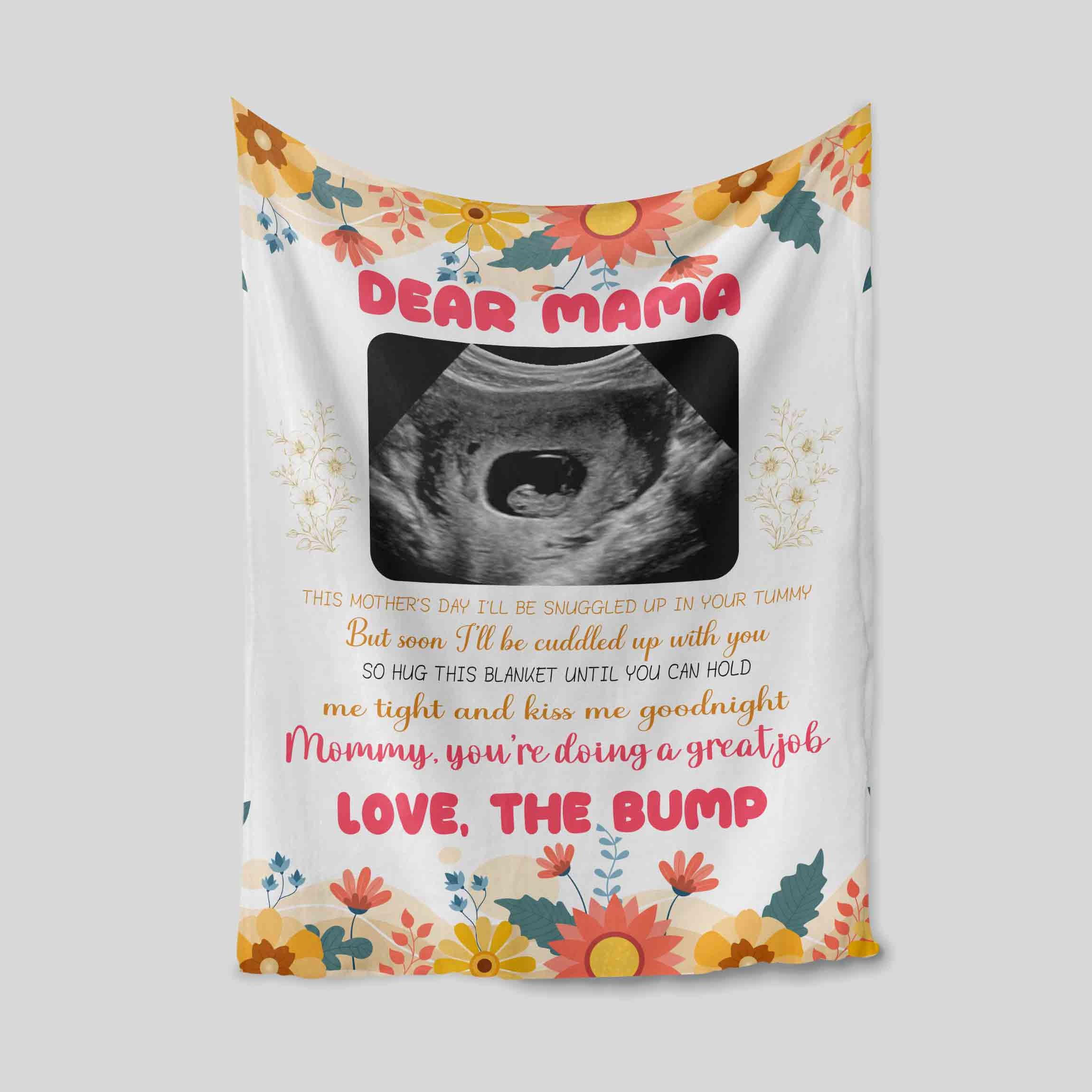 Personalized Baby Ultrasound Fleece Blankets Gift for Mom
